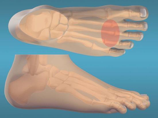 Foot & Ankle